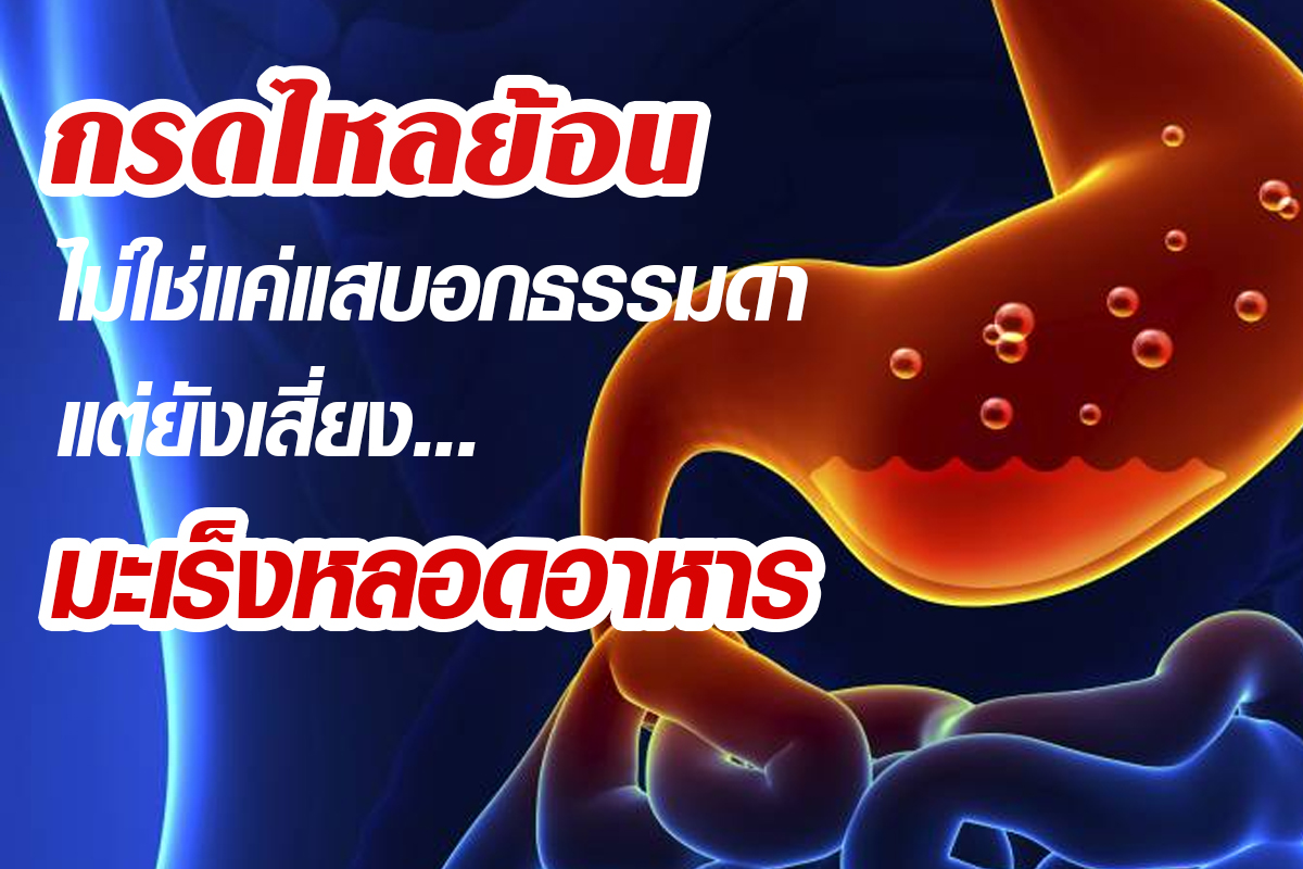 โรคกรดไหลย้อน โรคกรดไหลย้อน
