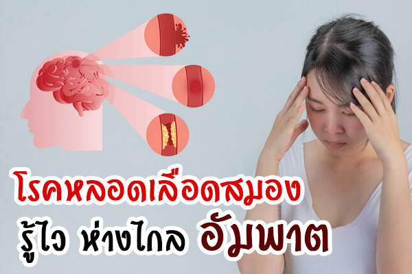 โรคหลอดเลือดสมอง โรคหลอดเลือดสมอง