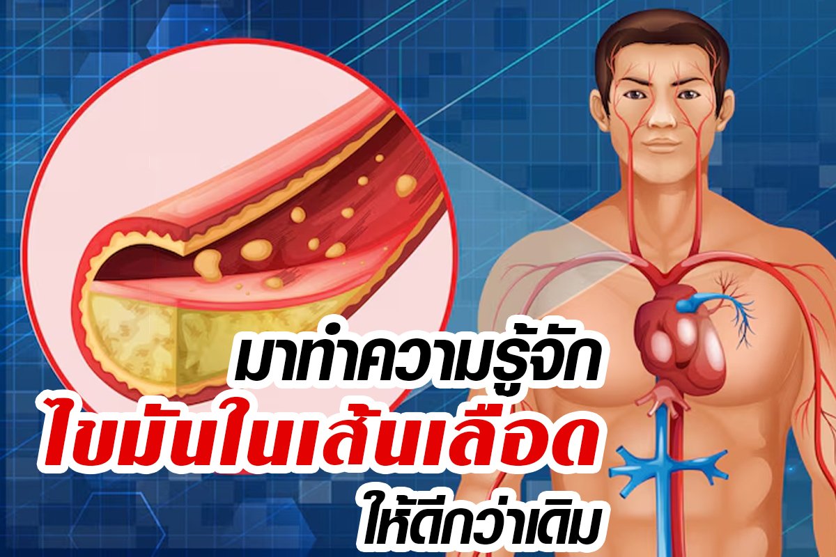 ไขมันในเลือดคืออะไร ไขมันในเลือดคืออะไร