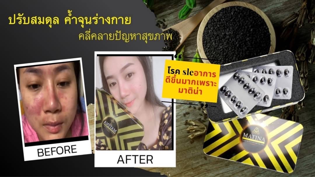 ประสบการณ์ผู้ใช้ มาทีน่า แบล็คเซซามีน