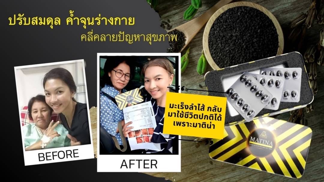 ประสบการณ์ผู้ใช้ มาทีน่า แบล็คเซซามีน